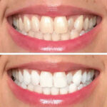 500ml Family Size Natural Alcohol-Free Antibacterial Oral Care & Mint Mouthwash — Fresh Breath - Image 11